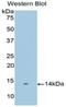 Prostate Stem Cell Antigen antibody, LS-C296069, Lifespan Biosciences, Western Blot image 