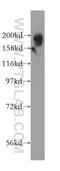 Kinesin Family Member 1B antibody, 15263-1-AP, Proteintech Group, Western Blot image 