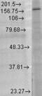 Glutamate Ionotropic Receptor NMDA Type Subunit 2B antibody, NBP1-47608, Novus Biologicals, Western Blot image 