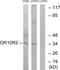 Olfactory Receptor Family 10 Subfamily S Member 1 antibody, GTX87128, GeneTex, Western Blot image 