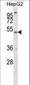 ALG11 Alpha-1,2-Mannosyltransferase antibody, LS-C156276, Lifespan Biosciences, Western Blot image 