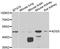 Adenylosuccinate Synthase antibody, STJ28599, St John