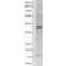 Potassium Voltage-Gated Channel Subfamily J Member 12 antibody, MA5-27678, Invitrogen Antibodies, Western Blot image 