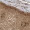 TNFAIP3 Interacting Protein 1 antibody, NBP1-90341, Novus Biologicals, Immunohistochemistry paraffin image 
