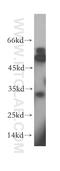 Retinol Dehydrogenase 12 antibody, 13289-3-AP, Proteintech Group, Western Blot image 