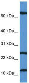 Tubulointerstitial Nephritis Antigen Like 1 antibody, TA343054, Origene, Western Blot image 