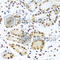 CIRBP antibody, A6559, ABclonal Technology, Immunohistochemistry paraffin image 