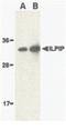 STE20 Related Adaptor Beta antibody, PA5-20035, Invitrogen Antibodies, Western Blot image 