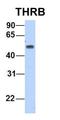 Thyroid Hormone Receptor Beta antibody, orb329953, Biorbyt, Western Blot image 