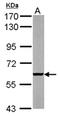 Poly [ADP-ribose] polymerase 3 antibody, ALX-210-971-R100, Enzo Life Sciences, Western Blot image 