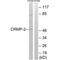 Dihydropyrimidinase Like 2 antibody, A02860, Boster Biological Technology, Western Blot image 