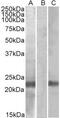 Cystatin 8 antibody, PA5-19252, Invitrogen Antibodies, Western Blot image 