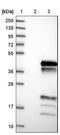 UBX Domain Protein 10 antibody, NBP1-83561, Novus Biologicals, Western Blot image 