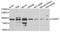 CD2 Associated Protein antibody, A7788, ABclonal Technology, Western Blot image 