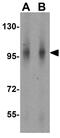 Nucleotide Binding Oligomerization Domain Containing 2 antibody, GTX31664, GeneTex, Western Blot image 