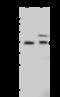 Serpin Family B Member 6 antibody, 203019-T32, Sino Biological, Western Blot image 