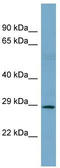 Snail Family Transcriptional Repressor 1 antibody, TA333929, Origene, Western Blot image 