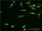 VAMP Associated Protein A antibody, H00009218-M01, Novus Biologicals, Immunocytochemistry image 