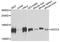 Activating Signal Cointegrator 1 Complex Subunit 3 antibody, orb373883, Biorbyt, Western Blot image 