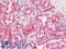 HCGV antibody, LS-C210850, Lifespan Biosciences, Immunohistochemistry frozen image 