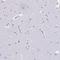 RNS3 antibody, HPA056183, Atlas Antibodies, Immunohistochemistry frozen image 