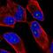 Zinc Finger Protein 136 antibody, NBP2-58400, Novus Biologicals, Immunofluorescence image 