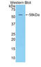 Killer Cell Immunoglobulin Like Receptor, Three Ig Domains And Long Cytoplasmic Tail 1 antibody, LS-C304344, Lifespan Biosciences, Western Blot image 