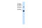 Solute Carrier Family 2 Member 5 antibody, 29-696, ProSci, Enzyme Linked Immunosorbent Assay image 