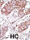 Bone Morphogenetic Protein Receptor Type 1A antibody, abx031355, Abbexa, Immunohistochemistry paraffin image 