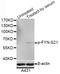 FYN Proto-Oncogene, Src Family Tyrosine Kinase antibody, STJ110850, St John