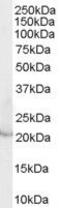 Lipocalin 2 antibody, PA5-18382, Invitrogen Antibodies, Western Blot image 