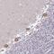 DEAH-Box Helicase 8 antibody, NBP2-13923, Novus Biologicals, Immunohistochemistry paraffin image 