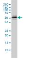 Parkin RBR E3 Ubiquitin Protein Ligase antibody, H00005071-M01, Novus Biologicals, Western Blot image 