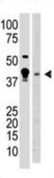 Methyl-CpG Binding Domain Protein 2 antibody, abx025844, Abbexa, Western Blot image 