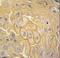 Discoidin Domain Receptor Tyrosine Kinase 1 antibody, LS-C97571, Lifespan Biosciences, Immunohistochemistry paraffin image 