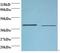 Beta-1,4-Galactosyltransferase 3 antibody, LS-C212338, Lifespan Biosciences, Western Blot image 