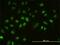 Ubiquitin Conjugating Enzyme E2 H antibody, H00007328-M01, Novus Biologicals, Immunocytochemistry image 