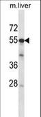 AarF Domain Containing Kinase 2 antibody, LS-C164291, Lifespan Biosciences, Western Blot image 