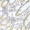 Interleukin 5 antibody, A7690, ABclonal Technology, Immunohistochemistry paraffin image 