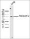 EPH Receptor A2 antibody, orb183283, Biorbyt, Western Blot image 