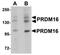 PR/SET Domain 16 antibody, orb75336, Biorbyt, Western Blot image 
