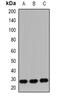 Insulin Like Growth Factor 2 antibody, abx225233, Abbexa, Western Blot image 