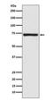 Calpain 1 antibody, M01943, Boster Biological Technology, Western Blot image 