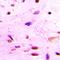 8-Oxoguanine DNA Glycosylase antibody, orb411993, Biorbyt, Immunohistochemistry paraffin image 