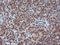 Protein Phosphatase 1 Regulatory Subunit 15A antibody, LS-C173753, Lifespan Biosciences, Immunohistochemistry paraffin image 