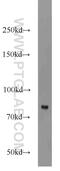 Hedgehog Interacting Protein antibody, 11654-1-AP, Proteintech Group, Western Blot image 