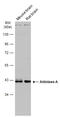 Aldolase, Fructose-Bisphosphate A antibody, GTX101408, GeneTex, Western Blot image 