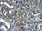 Ankyrin repeat and MYND domain-containing protein 2 antibody, M16611, Boster Biological Technology, Immunohistochemistry paraffin image 