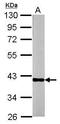 Ornithine Carbamoyltransferase antibody, GTX105140, GeneTex, Western Blot image 