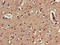 Killer Cell Immunoglobulin Like Receptor, Three Ig Domains And Long Cytoplasmic Tail 1 antibody, LS-C678445, Lifespan Biosciences, Immunohistochemistry paraffin image 